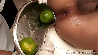 Kinky Medical Fetish Asians Non with an increment of Golf